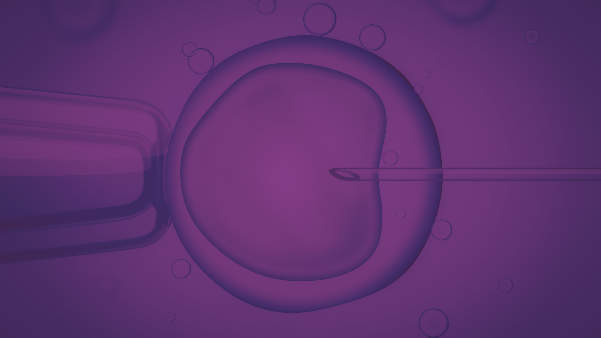 Slider-Image-in-vitro-fertilization