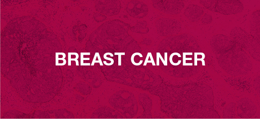 6_200366_DA_CRPC_and_HER2_Web Art_Banners_Breast_Cancer