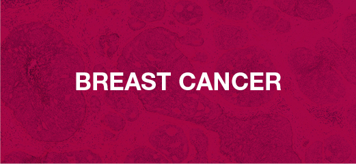 6_200366_DA_CRPC_and_HER2_Web Art_Banners_Breast_Cancer