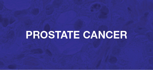 6_200366_DA_CRPC_and_HER2_Web Art_Banners_Prostate_Cancer