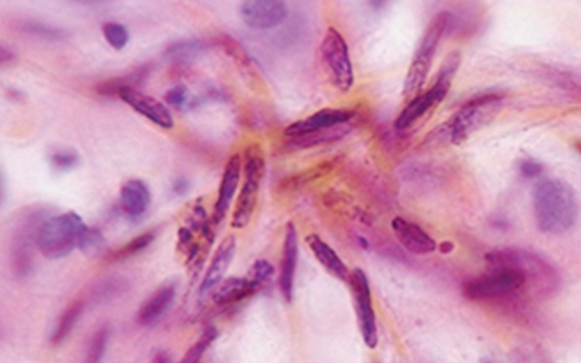 how does human papillomavirus cause cervical cancer