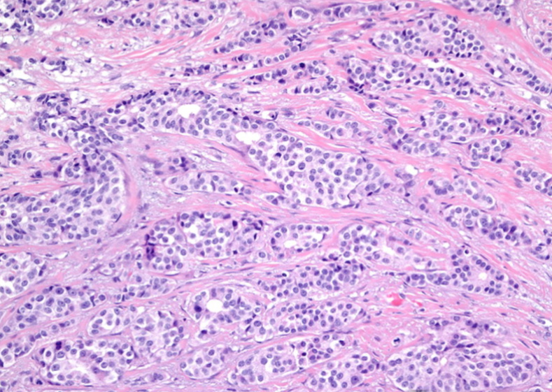 Cancer Diagnoses Patient Resource ASCP Patient Champions cancer-diagnoses-patient-resource-ascp-patient-champions
