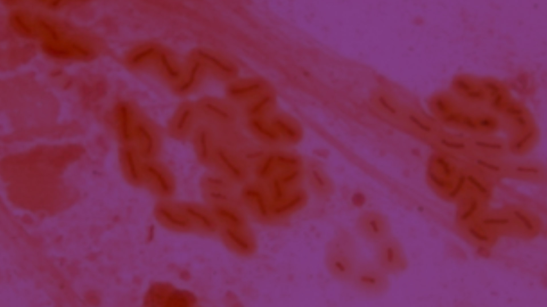 pseudomonas_aeruginosa_slider-Image