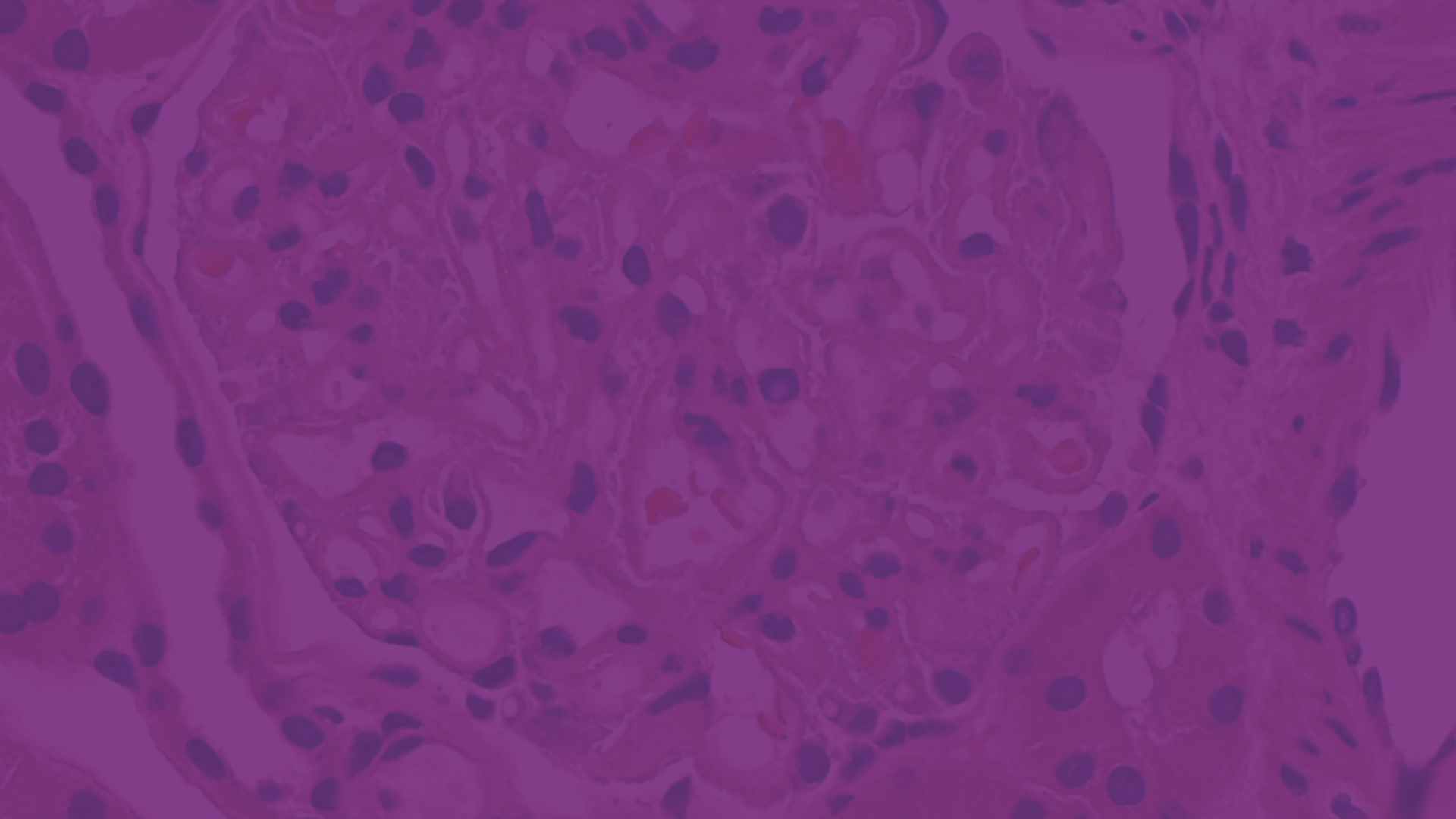 Slider-Image-lupus
