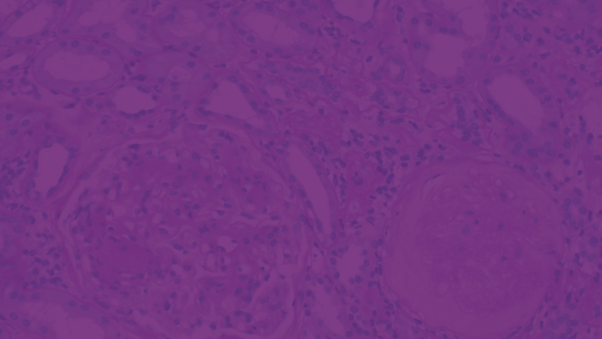 Slider-Image-renal-disease