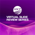ASCP Virtual Slide Review Series (On-Demand) Challenging Differential Diagnoses in Small Gynecologic Specimens