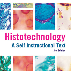 Diagnostic Histopathology Of Tumors Fletcher Free Download Diagnostic Histopathology Of Tumors Fletcher Free Download