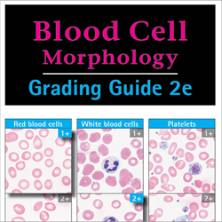 Rbc Morphology Grading Chart